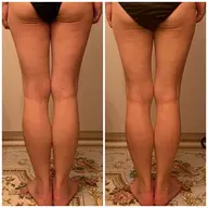 【サンダルの季節、足首から変わる】重だるい脚軽く細く60分｜痩身エステ