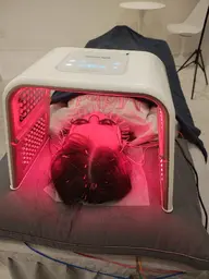 【学生様限定特別価格✨️】スタンダード美容鍼コース＋選べる1種手技＋韓国式LED美顔器　60分