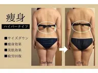 《美脚微尻集中》ハイパーナイフ+リンパマッサージ６０分￥9000→￥3500