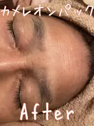 カメレオンパック