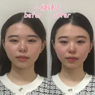 小顔矯正&カイロ骨格矯正全身110分