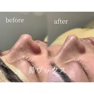 【オプション】鼻ワックス✨️ ⚠️こちらのメニューのみではご予約不可
