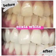 【土日祝】1回で6~8トーンアップ！★￥8800→￥2980★