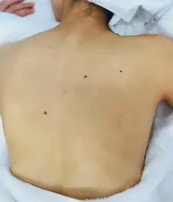 フェイシャル&背面アロママッサージ❣️