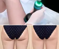 【痩身】オンダボディ：下半身痩せの救世主！痩身はもう冷却脂肪の次の時代へ ※2箇所