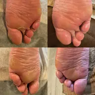 足裏徹底ケアコース🦶癖になる！足裏の角質から爪周りのケアまで徹底的に綺麗にします！