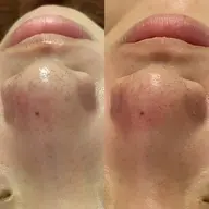 フェイシャルプチ