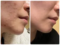 【新規限定】素肌美人コース ¥7,800→6,800（120分）