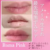 【ローマピンク🩷Roma pink】気になる黒ずみ悩みはまずカウンセリングへ♪