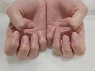 オフ＋ケア(ハンド)