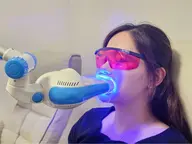 セルフホワイトニング美容、医療　２種類あり！2000円で美容セルフホワイトニングお試し体験！