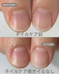 自爪育成モニター　ネイルケア