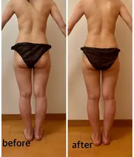 ⭐️写真撮影OKな方⭐️至極の全身リンパトリートメント➕選べるオプション(100分）通常12800円→5200円