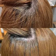 頭皮改善ヘッドスパ体験