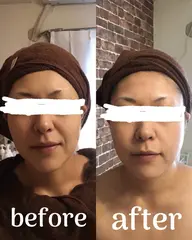 本格エステをお手頃価格で😳💝💫筋膜リリースで肩凝りがある方にもオススメ‼️リフトアップコース💆‍♀️✨✨