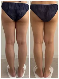 【伏見/脚痩せモニター】SNS・HP掲載協力で17,600円相当➔8,000円!選べる温熱or引締めケア✨月2枠限定