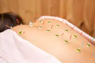 【首肩こり・頭痛・猫背・巻き肩・腰痛・反り腰・足のむくみに】✨お悩みに合わせて施術✨鍼灸・カッピング・かっさ‼️