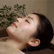 ≪リピーター様≫【美容鍼スタンダード】 60分¥12100🪡✨️ ‼️ご予約可能日は下記よりご確認下さい‼️