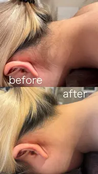 ミニモ学割👩🏼‍🎓全身脱毛(顔、VIO込み) | 40%OFF❣️16,500→＼9,900円／