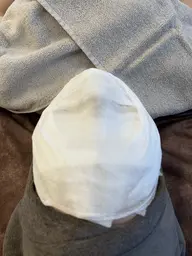 美白✕ハーブピーリング🌿モニター!剥離なし、DTなし!※モニター価格のため現金 or PayPay支払いのみ