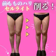 足痩せ人気No.1✨筋肉太り、むくみ、セルライト頑固な脂肪を必ず削ぎ落す🔥サイズダウンしながら痩せやすい身体に🐰ིྀ
