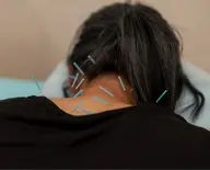 【首肩腰の慢性痛に⚡️】鍼施術60分（カウンセリング付き