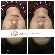 【小顔チューニング】眠れる5gの極低刺激。筋膜をゆるめ、キュッと引き締まる小顔へ