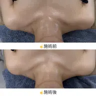 🌊夏本番前🌊【フェイシャル・デコルテトリートメントコース】