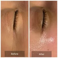 韓国モデル❤️小顔陶器肌コース【メラニンを含む古い角質毛穴汚れ除去💎】お茶カウンセリング込120分