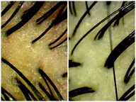 じっくり40分ヘッドスパコース