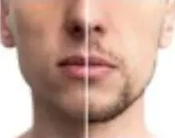 メンズヒゲ脱毛✨️🔥【格上の男の身だしなみ‼️】髭全体ラグジュアリー脱毛💪¥13980→3980