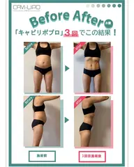 通常−55%off★【全身】ｷｬﾋﾞﾃｰｼｮﾝ×温め×EMSで夏に向けてスリムダウン！