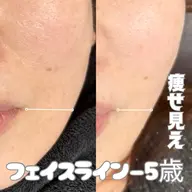 毛穴ケア+フェイスたるみケア