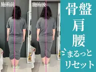 ゲリラ割引★ 【ママ人気】抱っこ・授乳でつらい首肩腰をまとめてケア！初回体験60分¥3,980