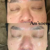 【毛穴洗浄（メンズ）】毛穴/くすみ/ざらつきに🫧ミニモ限定（通常7800円）