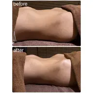 巡りスイッチON！溜め込みを脱ぎ捨てる、腸デトックス