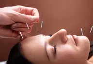 【OPEN記念⭐️人気No.3】美容鍼60分
