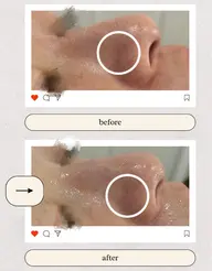 【毛穴洗浄デビュー】気になる1ヶ所集中!選べるワンパーツ(頬・鼻・口〜顎周り)毛穴洗浄☆角栓・黒ずみケア