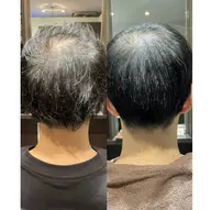 カット&縮毛矯正（90​〜​120分）