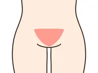 【レディース】VIO選べる部位ワックス脱毛『V』/はみ毛防止・デザイン可能！毛量により割引き制度あり◎