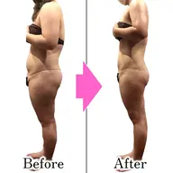 夏太り解消！！ハンドとマシンで短期集中・超得【70分×2日】🍀激やせW全身痩身🍀