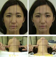 【新規】顎関節矯正・アゴの不調・開口辛さ・ガクガク感◆￥9,400 → ￥4,980現金限定