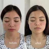 韓国ツヤ肌❤️‍🔥SNOW PEEL✖️LHA SHOT