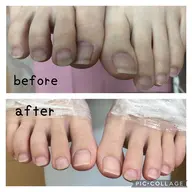 【足爪お手入れ+足裏角質除去】オフ無料/爪のお手入れ/足裏角質除去/フットバス/保湿パック/ふわつやの素肌へ