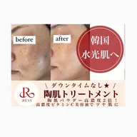 🌿REVIハーブピーリング🌿➕高濃度ビタミンC美容液