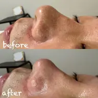 眉も小鼻も同時に綺麗に‼️ハリウッドブロウリフト+鼻の艶肌wax(箇所変更可能)