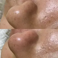 眉waxと鼻waxセットメニュー