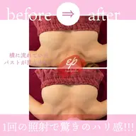 究極のバストケア💐💕ふわふわましゅまるおっぱいに✨️ナイーブなお悩みなのでまずは無料カウンセリングへお越しください。