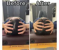 頭の整体(ドライヘッドスパ)