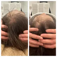 顔のむくみ、たるみ、ゆがみが気になる方に人気！美脳小顔矯正 3,900円